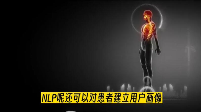 人工智能在医疗系统里能做什么？